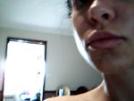 next day after treatment